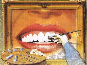 Имплантация зубов в Германии